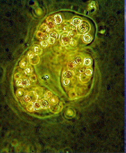 Microcystis aeruginosa cell